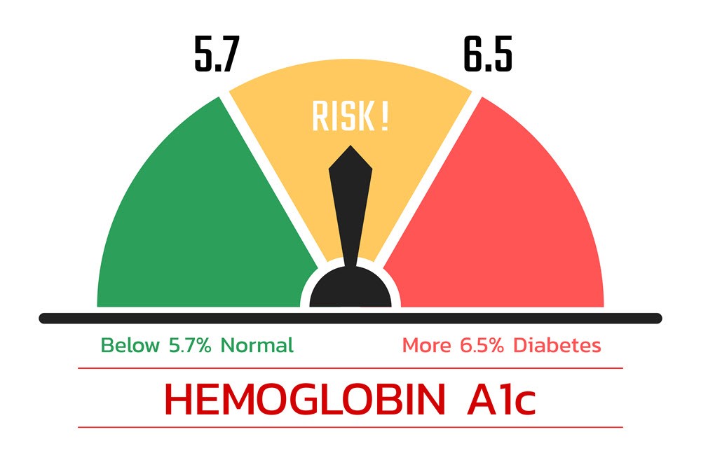 Hemoglobin A1C depiction