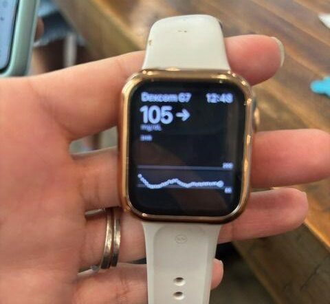 Blood glucose numbers on the apple watch