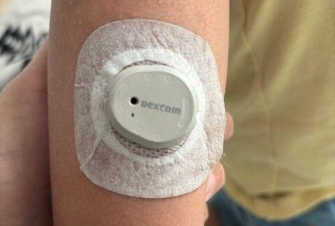 My Review of Upgrading to the Dexcom G7 and Tandem Control IQ for a Child